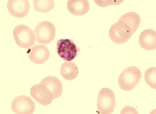 Joskus merotsoiitit saattavat muodostaa ruusukkeita (Laboratory diagnosis of Pl