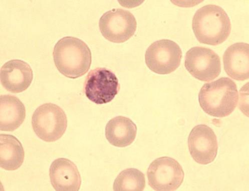 malariaen gametosyytit ovat muodoltaan pyöreitä tai ovaaleja ja ne täyttävät infektoituneen solun melkein kokonaan.