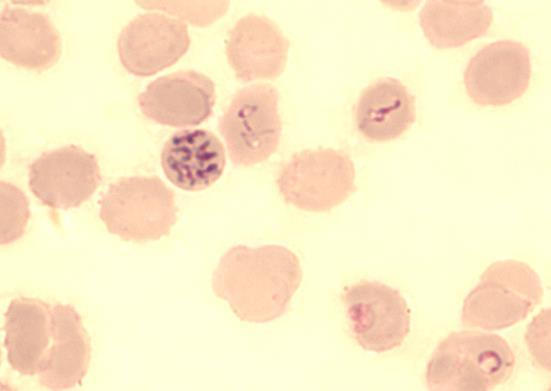 25 Kuvio 20. Vasemmalla on plasmodien infektoimia punasoluja. Oikealla taas on babesioita solujen sisällä, vaihtelevin muodoin. 3.1.4.