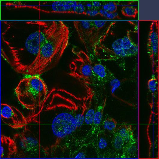 31 Konfokaalikuvissa 22 päivää vanhoissa nähdään poikkileikkauskuvista (ylä- ja oikea reuna) troponiini T:n värjäytyneen osittain solun sisälläkin (kuva 9).