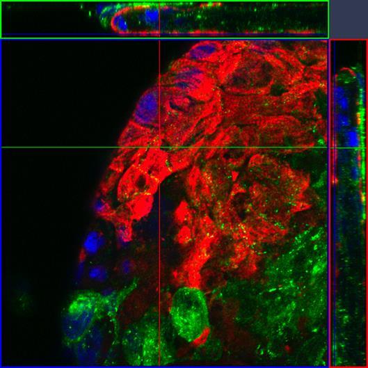 33 377 päivää vanhan soluaggregaatin pinnalla nähdään sarkomeerirakenteet sekä selkeästi konneksiinin sijoittuvan solujen välisiin liitoksiin (kuva 11).