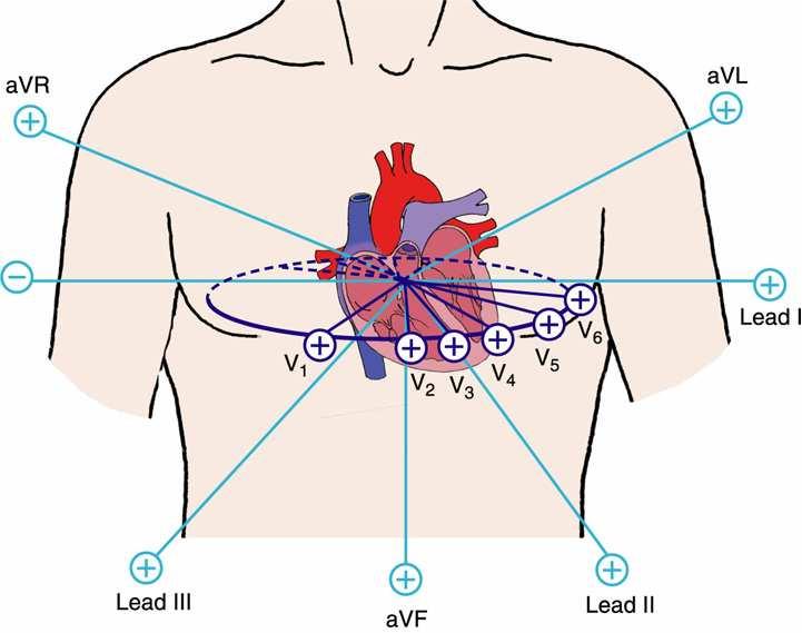 11 Elektrodien muodostamat kytkennät mittaavat sydämen sähköistä toimintaa eri kulmista kuvan 3 mukaisesti. Kuva 3. Eri EKG-kytkentöjen antamat kuvat sydämestä (Lippincott 2005).