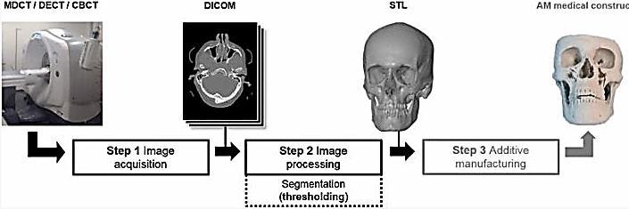 4.4 Lääketieteellisen 3D-mallin työnkulku 3D-mallin valmistus kuvasta fyysiseksi objektiksi on useiden eri alojen tuntemusta vaativa prosessiketju.