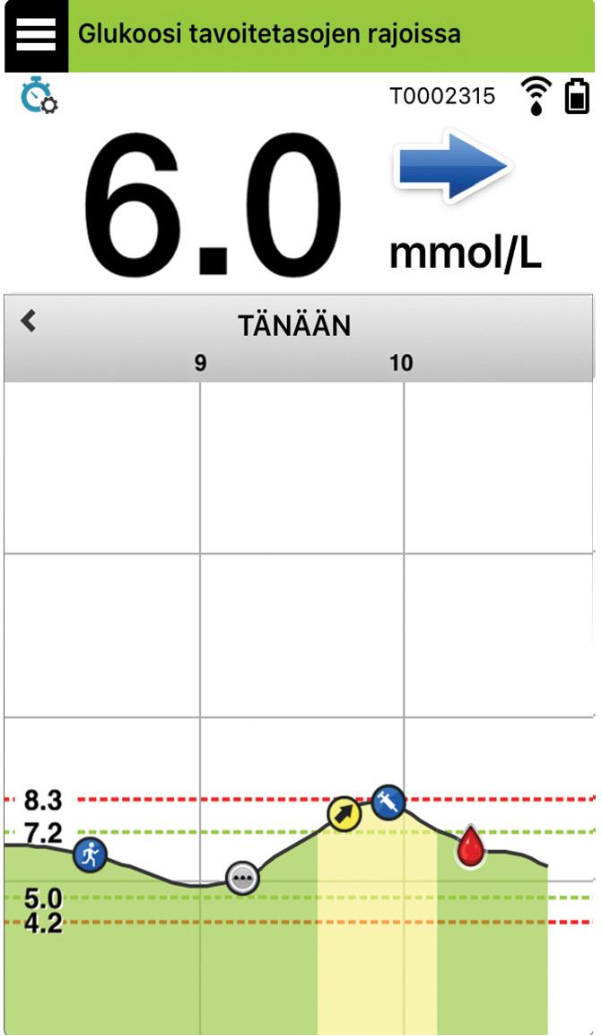 Eversense App Älylähetin on langattomassa yhteydessä sovellukseen glukoositietojen, trendien, kaavioiden ja varoitusten näyttämistä varten.