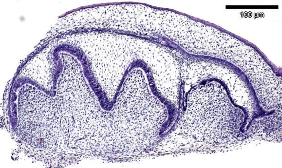 Initiaatio HAMMASPLAKODI Morfogeneesi Muodon kehittyminen Solujen erilaistuminen SILMU LAKKI kiillekyhmy KELLO Kovakudosten muodostuminen Biomineralisaatio FUNKTIO Piirros: Carin Sahlberg