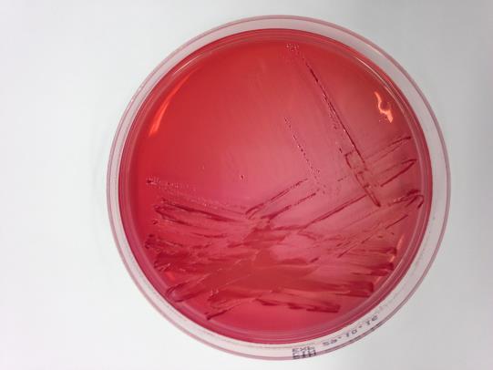 12 Viljelyssä käytetään selektiivistä antibiootteja sisältävää CIN (Cefsulodin-Irgasan-Novobiocin) -elatusainemaljaa.