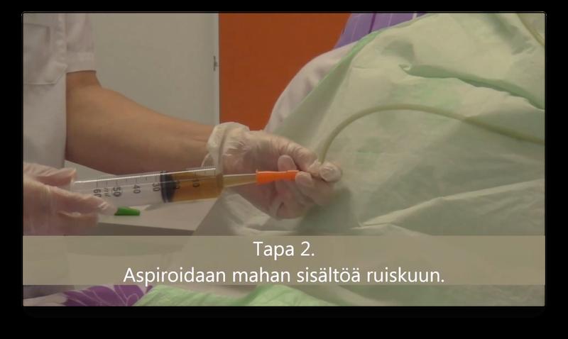 21 kun avulla 5-10 ml ilmaa nenä-mahaletkun kautta mahalaukkuun. Samalla kuunnellaan stetoskoopilla ylävatsaa. Jos nenä-mahaletku on mahalaukussa, kuuluu stetoskoopilla ilmakurahdus (kuva 4b).