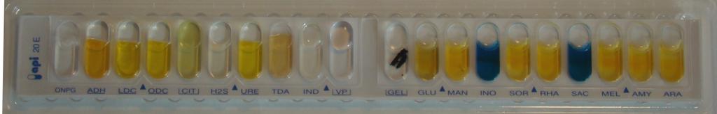 Näyte 2/2013. Klebsiella pneumoniae ssp. rhinoscleromatis 1.