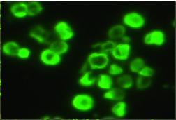 Immunosuppressiona Tacro-MMF-Medrol Krea noussut hiljalleen 80