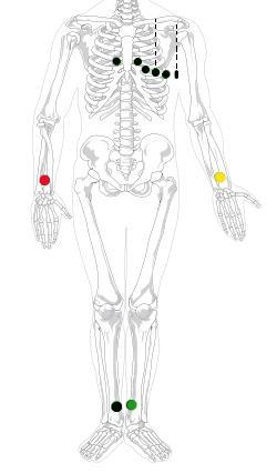 EKG taulu LIITE 2 4(4)