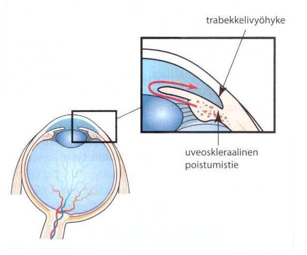 19 Terveessä silmässä kammioneste ulosvirtaa suurimmaksi osaksi trabekkelivyöhykkeen kautta sekä vähemmän uveoskleraalivirtauksessa.