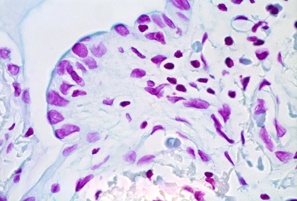 Feulgen. Feulgen- värjäysmenetelmän spesifisenä biokemiallisena periaatteena on deoksiriboosin osoittaminen nukleiinihappomolekyyleistä.