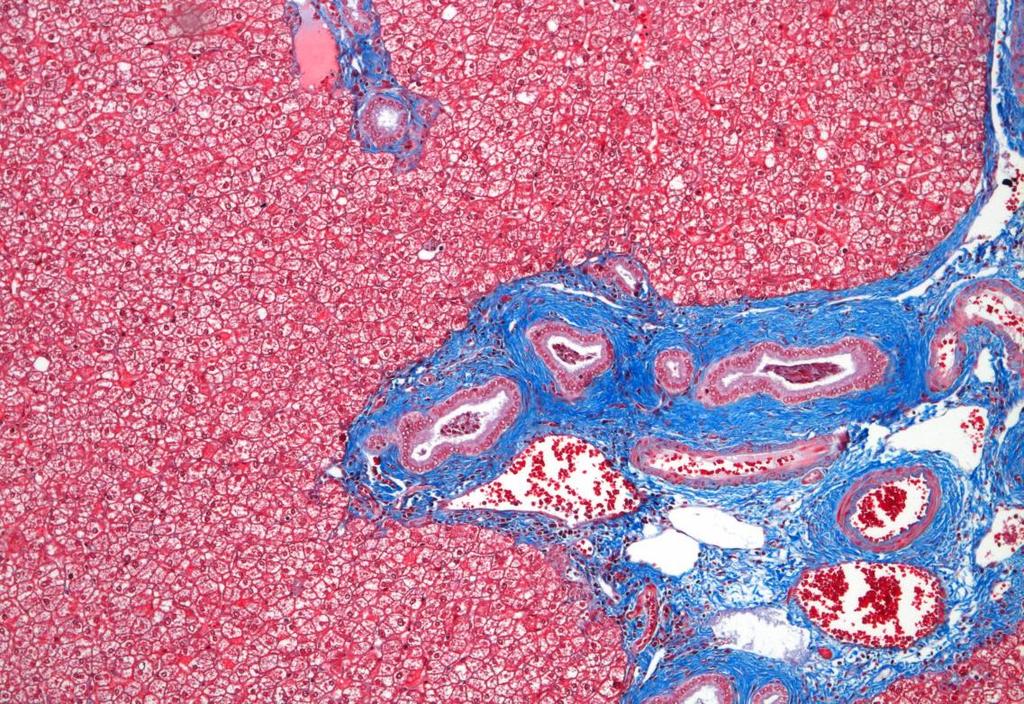 2015. OYS. Patologian vastuualueen laatukäsikirja.) Värjäyksessämme histologisena kudosleikkeenä oli maksa- ja maksakirroosikudosta.