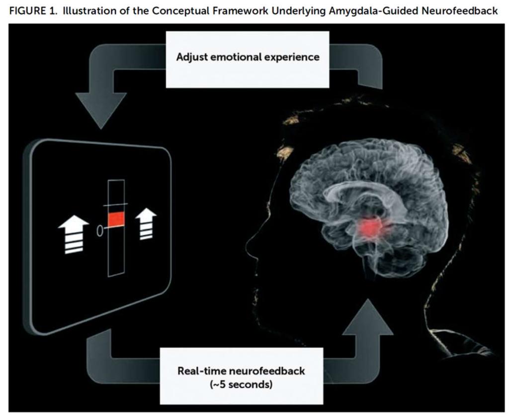 Neurofeedback depression hoidossa??? Williams LM. Am J Psychiatry 2017;174:717-18.