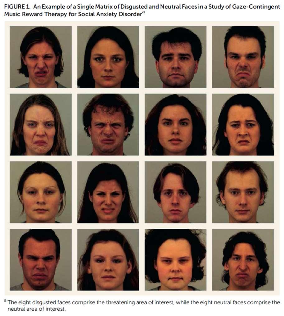 Gaze-Contingent Music Reward Therapy for Social Anxiety Disorder??? Uunituoreessa tutkimuksessa selvitettiin uuden hoitomuodon tehoa sosiaaliseen fobiaan.