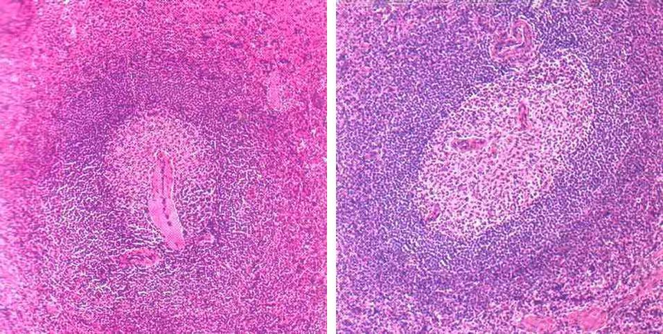 Useimmissa lymfanoduluksissa (follikkeli) erottuu keskusvaltimo (central artery tai nodular artery). Erotatko itukeskuksen (germinal center) ja sitä ympäröivän vaipan (corona, mantle).