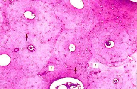 6 s; 224, plate 12 s247; Tiivis luu matriksin kollageeni värjäytyy eosinofiilisesti PKTÄISLEIKKAUS HE-värjäys.