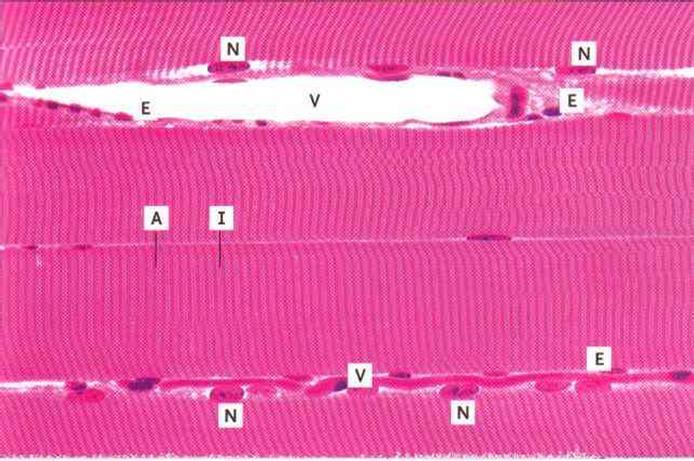 Rustosyntyinen luu PB=Luukalvosin EB=endochondraalista luuta Epifyysirusto Epifyysirusto Lihaskudos Poikkijuovaista lihasta - kielenkärkeä ja/tai hartialihasta. Näyte #22.