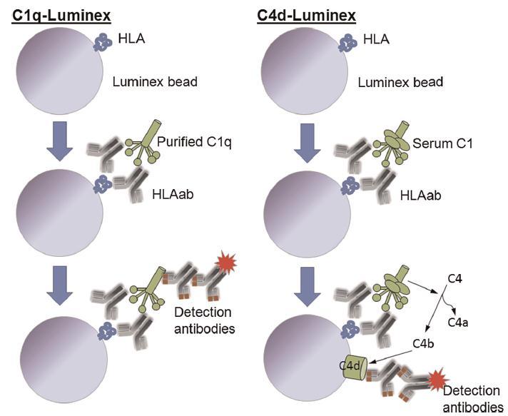 HLA vasta-aineiden tutkimusmenetelmät C1q ja Cd4 menetelmät Luminex