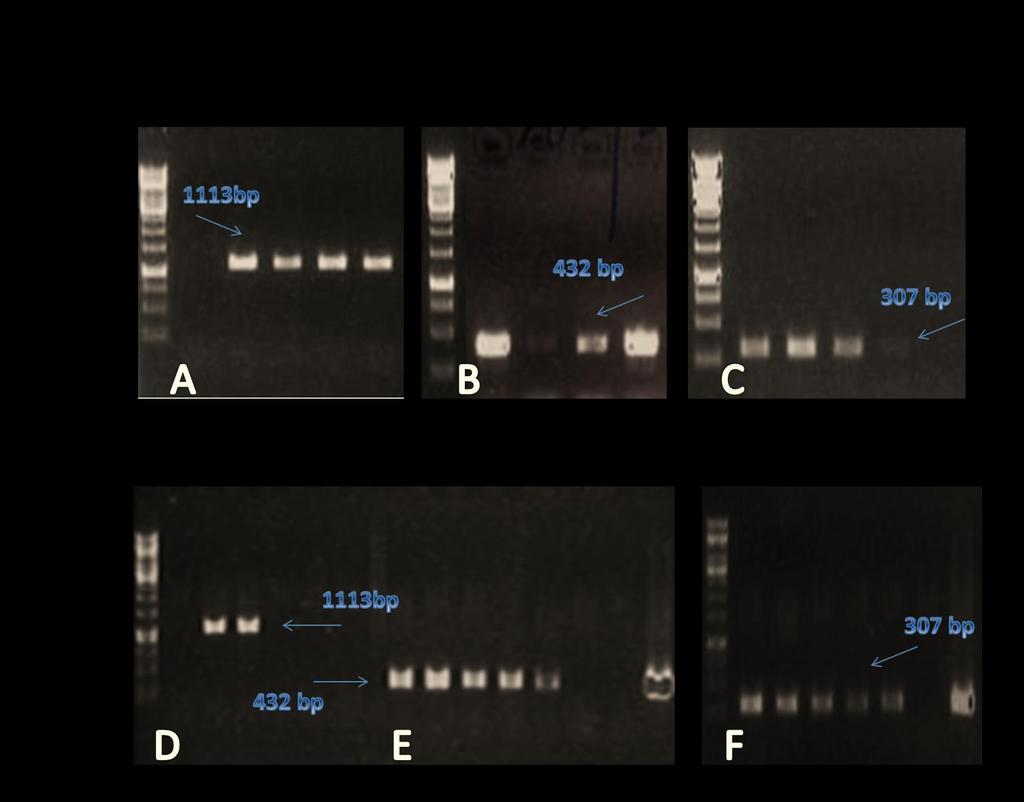36 Transformanttien oikeellisuuden tarkistus PCR:llä on esitetty kuvassa 16.