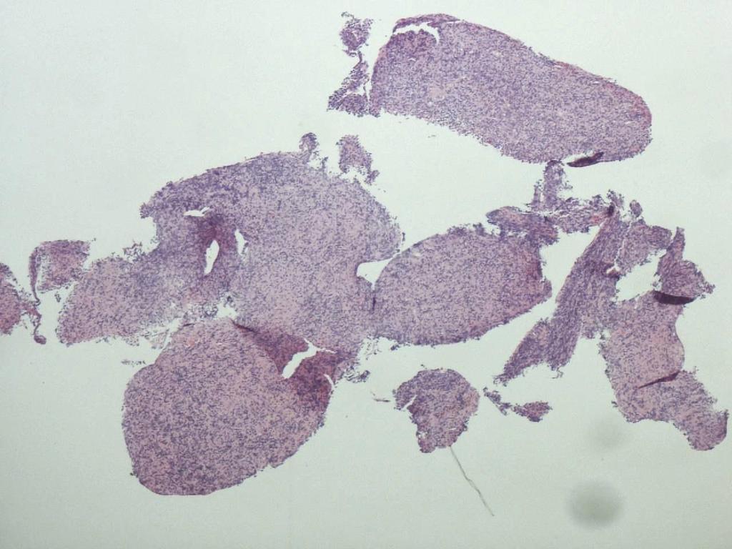 Biopsia d 48