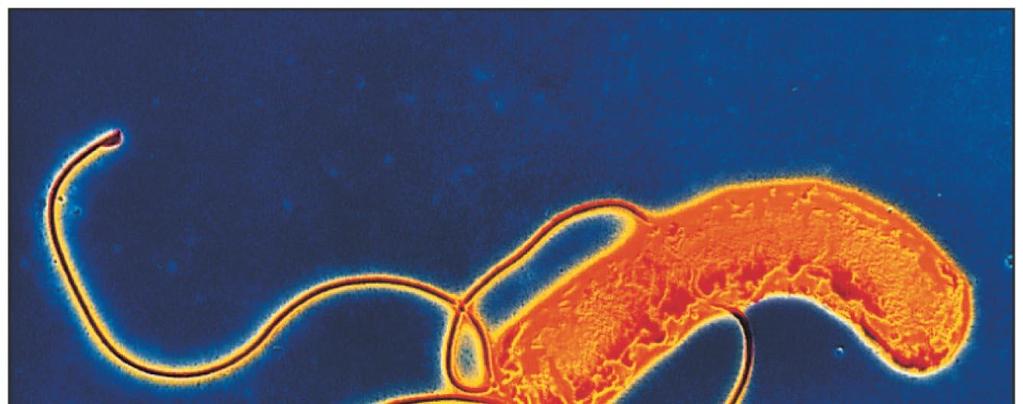 The Epsilonproteobacteria Helical or curved; microaerophilic Campylobacter