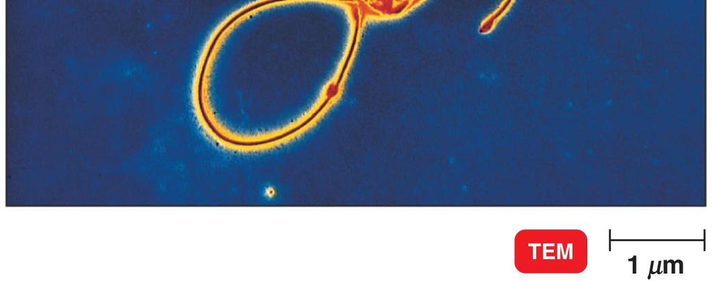 jejuni causes foodborne intestinal disease Helicobacter Multiple flagella