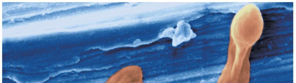 The Gram-Positive Bacteria Firmicutes (low G + C ratios) Actinobacteria (high