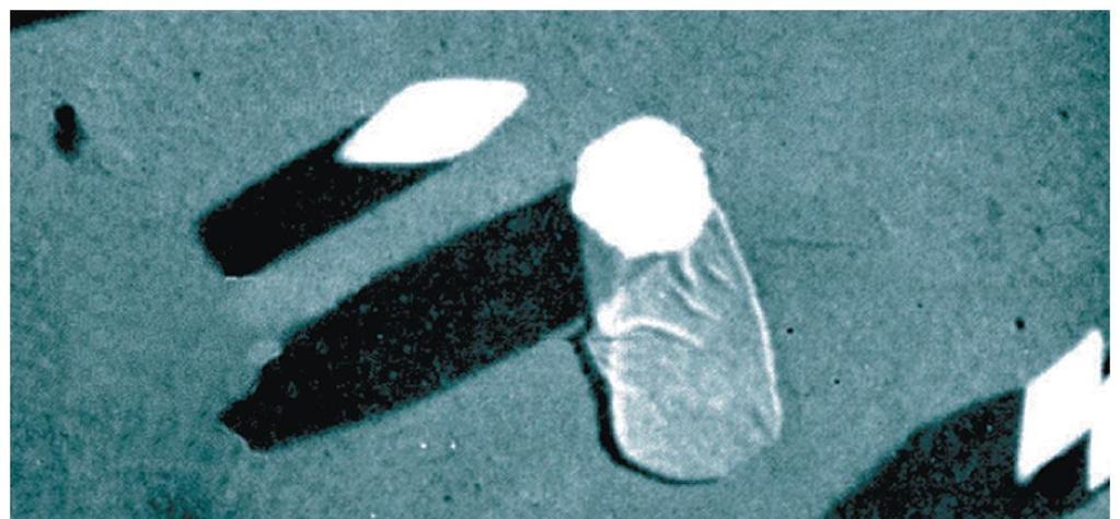 Firmicutes (Low G + C Gram-Positive Bacteria) Bacillales Bacillus Endospore-producing rods B. anthracis causes anthrax (pernarutto) B. thuringiensis is an insect pathogen B.