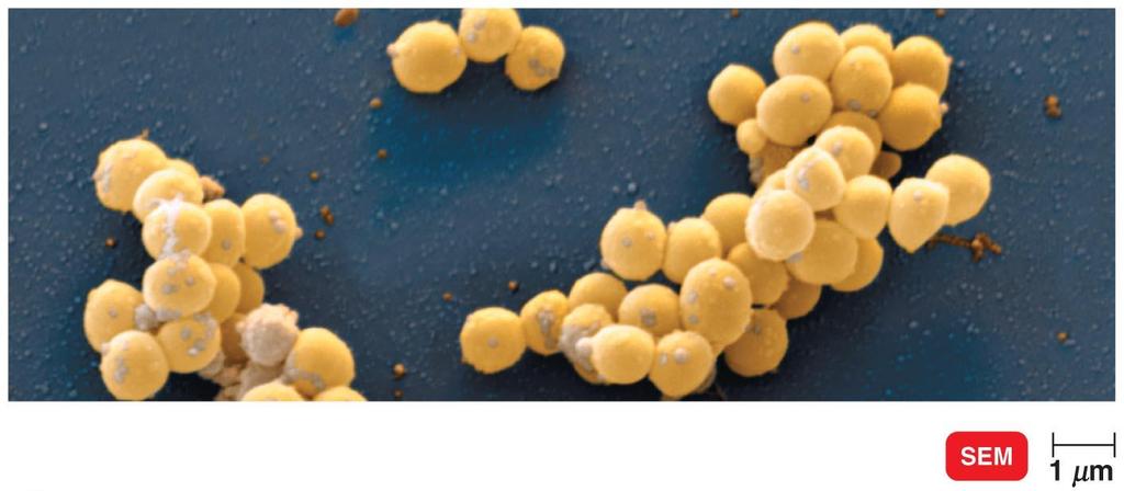 Figure 11.22 Staphylococcus aureus.