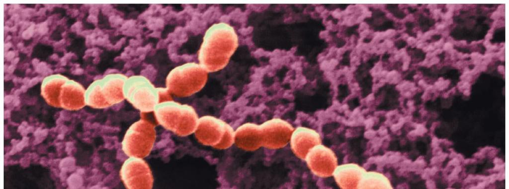 Firmicutes (Low G + C Gram-Positive Bacteria) Lactobacillales (cont'd) Streptococcus