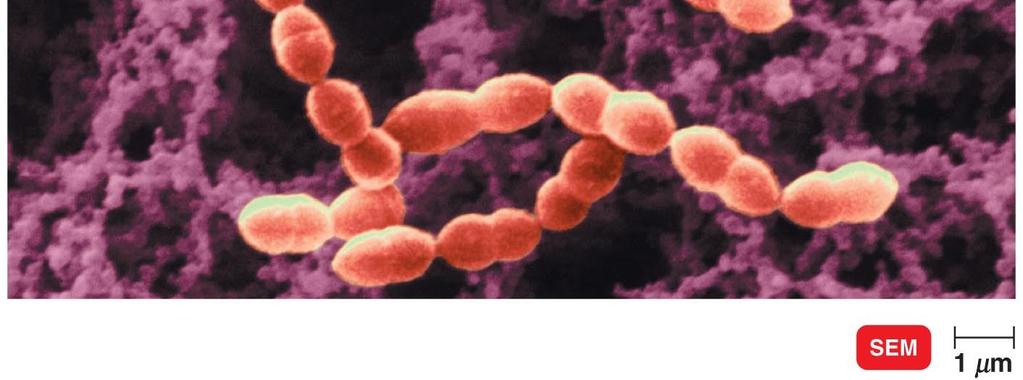 Beta-hemolytic streptococci hemolyze blood agar; includes S.