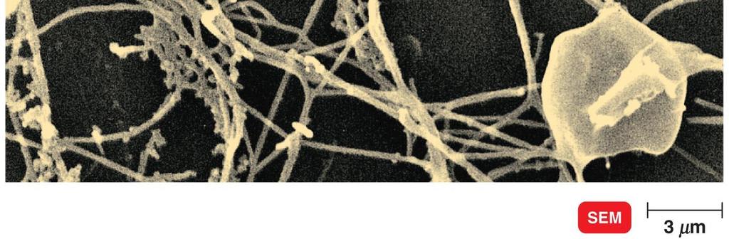 concentration >25% Thermophiles Require growth temperature