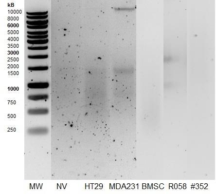KUVA 4 cdna koostekuva PCR-reaktioihin tarvittiin parhaimman laatuista cdna:ta, josta PRC-reaktiolla saadaan tuotettua haluttua DNA jaksoa.