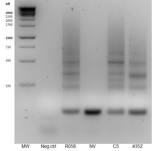 KUVA 5 testi-pcr Esi-PCR-reaktioissa alukkeilla Fn+ ja Fn-, F+PCR ja Fn-3 sekä F+1 ja Fn-3 saatiin tuotettua oikeankokoiset fragmentit, joka nähdään agaroosigeeliltä verrattaessa DNA-vyöhykkeen
