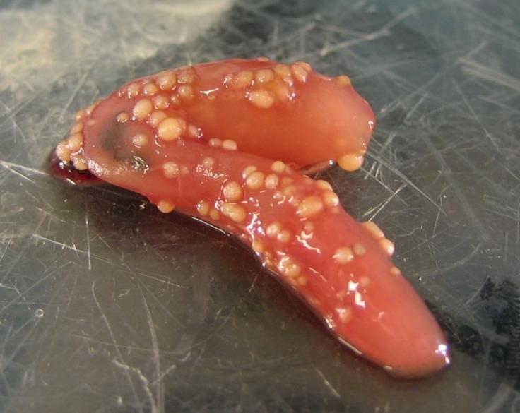 Lokin ja sukeltajasorsan lapamato Diphyllobothrium ditremum ja D.