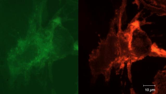 33 5.3 Värjäykset Ibideissä kasvatetut primaariset endoteelisolut, jotka eivät kasvaneet tarpeeksi konfluenteiksi kapillaarivirtausmenetelmän kokeita varten, värjättiin fluoresoivilla vasta-aineilla