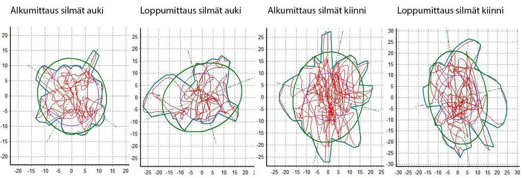 47 80 60 40 60,9 Silmät auki 43,6 Silmät kiinni 20 9,1 4,8 14,2 11,8 0-20 -0,2-16,2-14,7-10,1-40 -37,8-37,8-60 Rombergin vakio Huojunnan pituus (mm) X-suuntainen keskihajonta (mm) C90 pinta-ala (mm²)