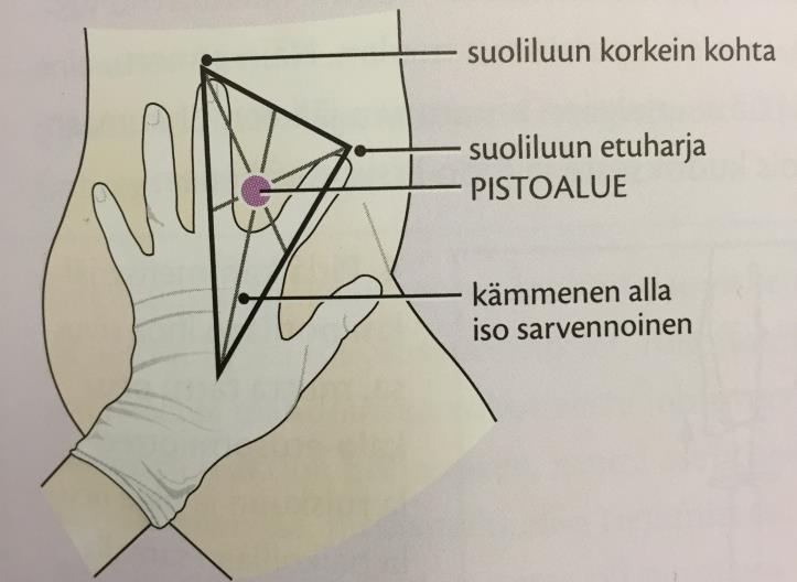 18 Kuva 6. Pistoskohdan paikallistaminen von Hochsetterin kolmion avulla (Rautava- Nurmi ym 2015, 151) 7 VANHAINKOTI OSMANRINNE Vanhainkoti Osmanrinne sijaitsee Eurassa. Se on valmistunut vuonna 1972.