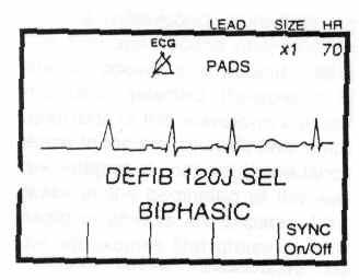 M -sarjan kanttiaaltoinen bifaasinen defibrillaattori tuottaa tasavirtaa, maksimienergia on 200 Joulea.