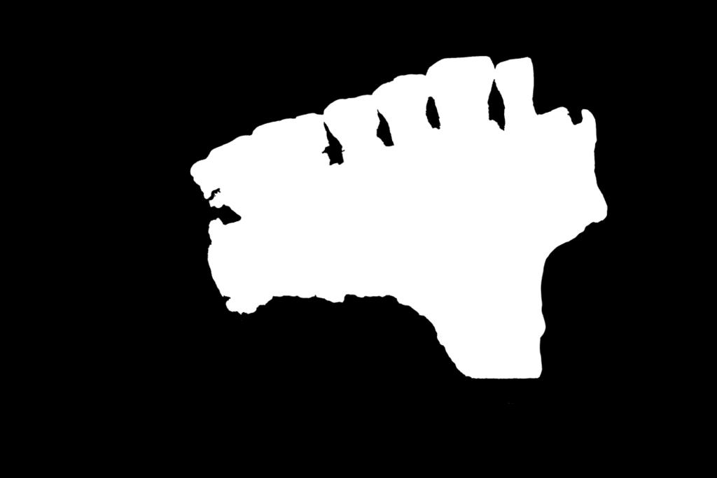 50 Iin Haminan vainajien nuorin ikäryhmä näyttää osoittaneen hieman enemmän patologisuutta ja vanhin vastaavasti vähiten (Taulukko 11).