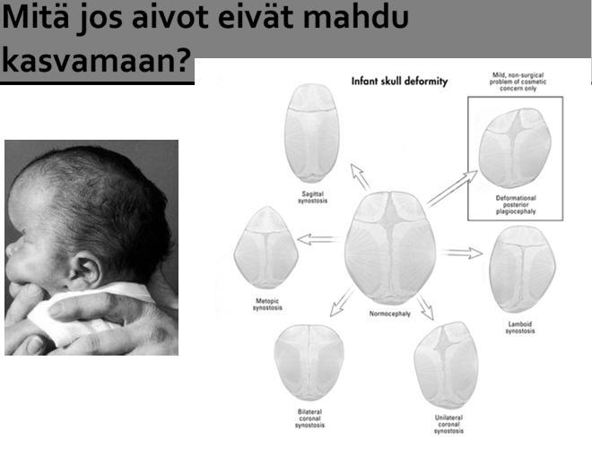 ASPM säätelee sikiön neuroblastien normaalin tumasukkulan toimintaan ja ilmentyy normaalin neurogeneesin aikana aivokuoressa Osa