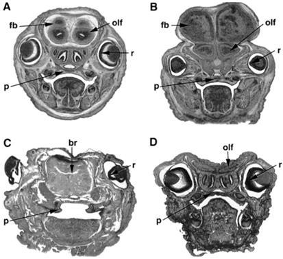 Phenotypic variation in Apaf-1-deficient newborns closely resembles that seen in fog embryos.