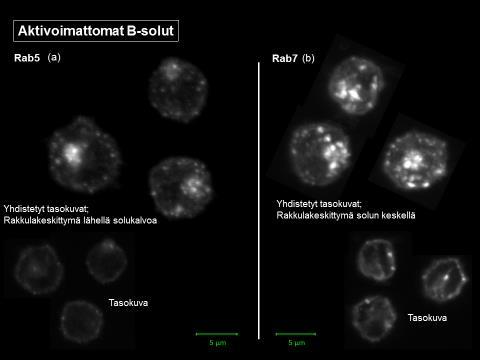 31 Kuva 10. Rab5 ja Rab7 aktivoimattomissa B-soluissa. Rab9 (kuva 11 a) vaikuttaa olevan hyvin aktiivinen sekä solukalvolla että rakkulakeskittymässä lepäävissä B-soluissa.