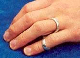 WE Butonnière (napinläpi) / Mallet 5014 Butonnière sormituki sopii parhaiten lieviin napinläpi-virheasentoihin sekä Mallet finger virheasennon korjaamiseen.