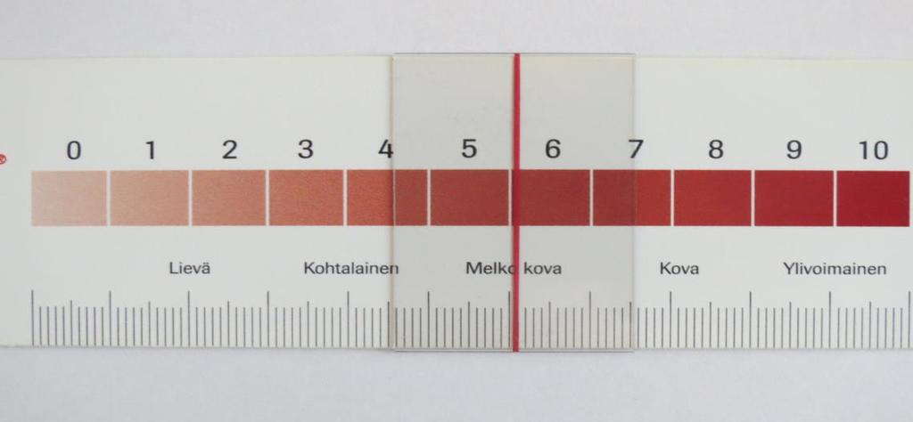 7 Kuvio 2. Numeerinen asteikko kiilan kääntöpuolelta, jossa 0 tarkoittaa kivuttomuutta ja 10 ylivoimaista kipua.