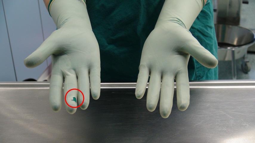 23 ja ortopedisissä leikkauksissa, koska käsineet joutuvat kovaan rasitukseen ja saattavat rikkoutua leikkauksen aikana instrumentteja käsiteltäessä.
