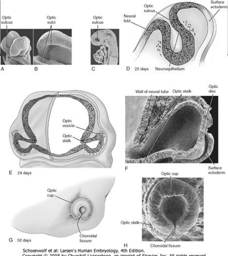 pullistumasta muodostuu silmämaljan ja myöhemmin retinan eli verkkokalvon aiheet