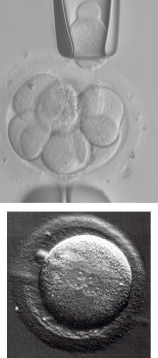 PGD-diagnostiikka Laboratorion kanssa sovittava tarkasta aikataulusta mahd.
