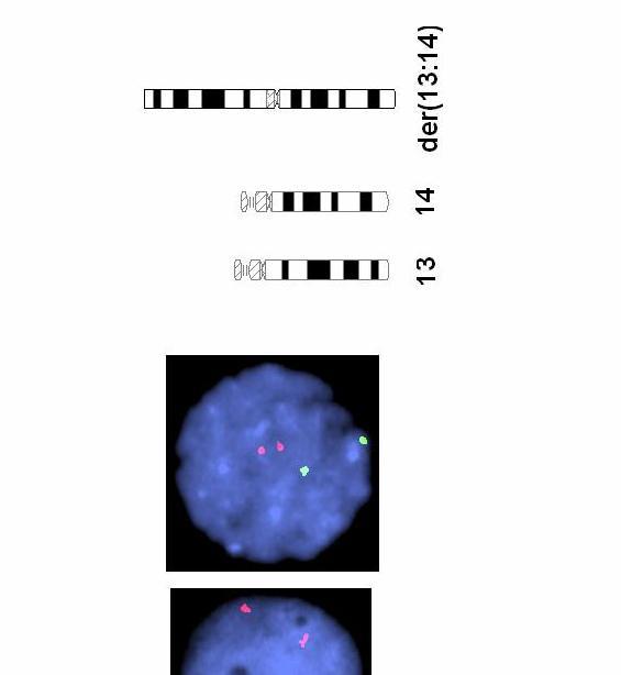 Molekyylikaryotyypitys (MK) Menetelmän avulla voidaan havainnoida kopiolukumuutoksia (CNV copy number variation) koko ihmisgenomin alueelta